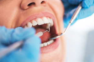 Advancements in Oral Care: Transforming the Dental Industry